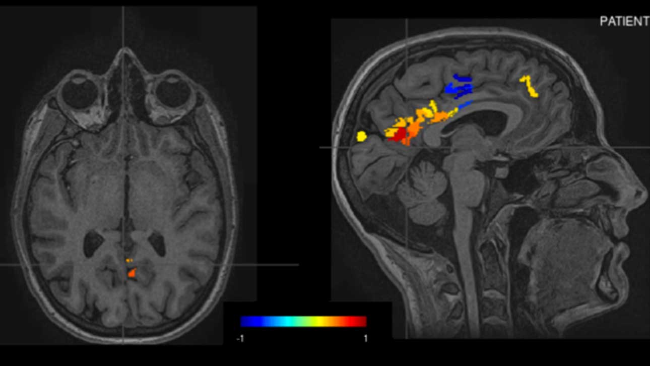 Western News - Neuroscientist partners with law firm for concussion research